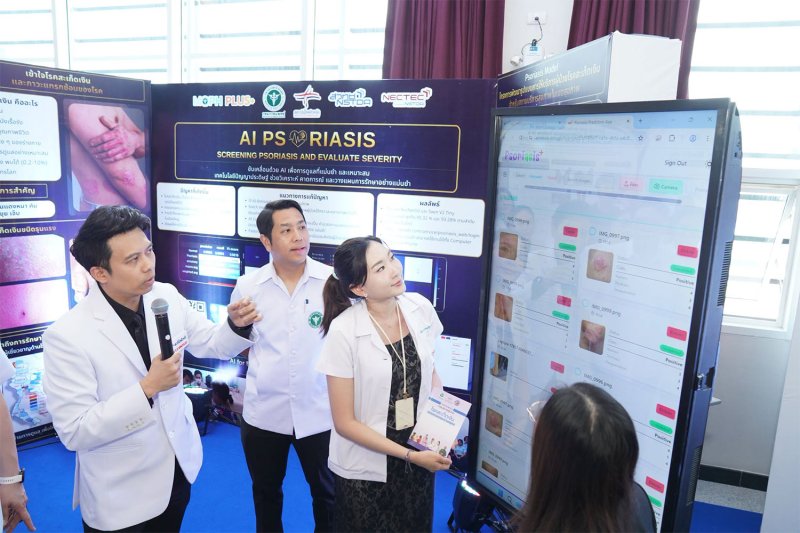 ผลลัพธ์จากการสแกนด้วยแอปพลิเคชัน AI Psoriasis ถูกนำเสนอในนิทรรศการที่สถาบันโรคผิวหนังในกรุงเทพฯ เมื่อวันจันทร์ (ภาพ: สถาบันโรคผิวหนัง)