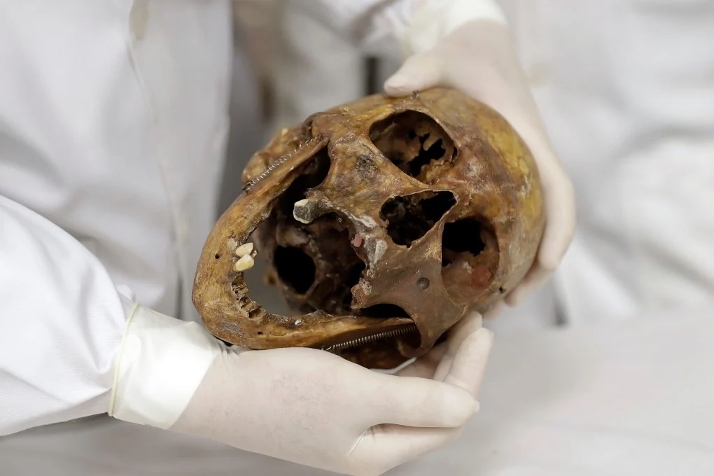 นายแพทย์นิติเวช Daniel Munoz กำลังแสดงกะโหลกศีรษะของอาชญากรสงครามนาซี Josef Mengele ที่คณะแพทยศาสตร์ มหาวิทยาลัยเซาเปาโล ในบราซิล เดือนธันวาคม 2016