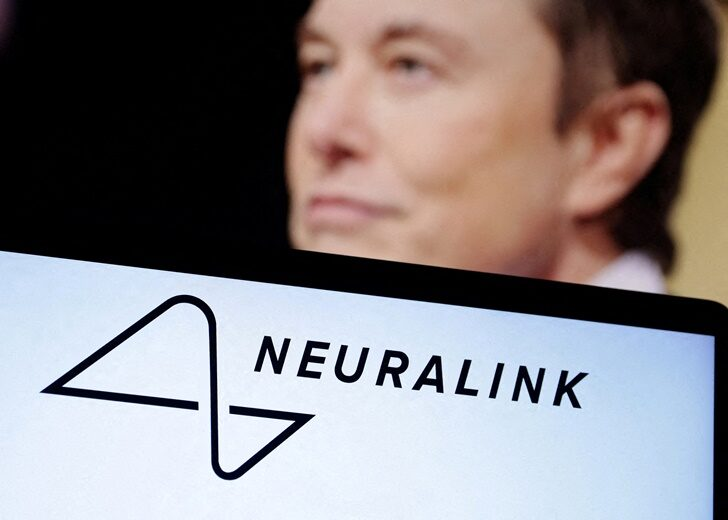 Neuralink ปลูกถ่ายชิปในสมองมนุษย์รายแรก เผยผลลัพธ์ช่วงแรกมีแนวโน้มที่ดี  