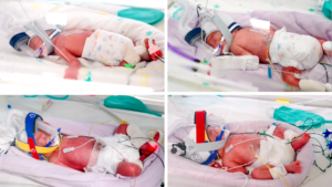 rare-identical-quadruplets-born-in-australia